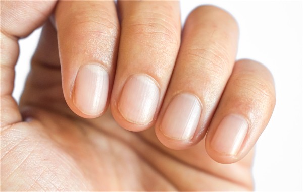 Unhas Saudáveis: Segredos Dermatológicos para Fortalecer e Revitalizar Suas Unhas