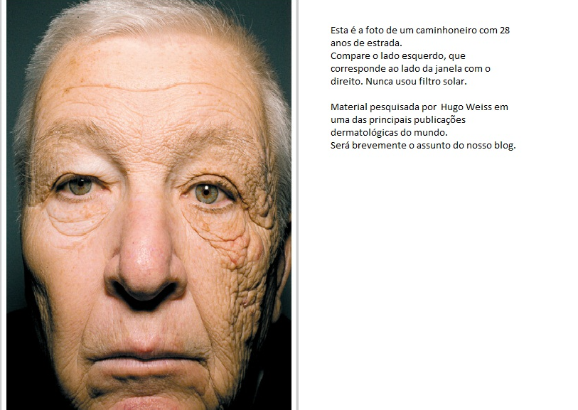 Vocês se lembram do caminhoneiro sem filtro solar por 28 anos?
