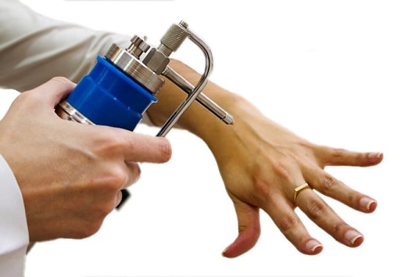 Médico aplicando crioterapia no braço e mão de paciente