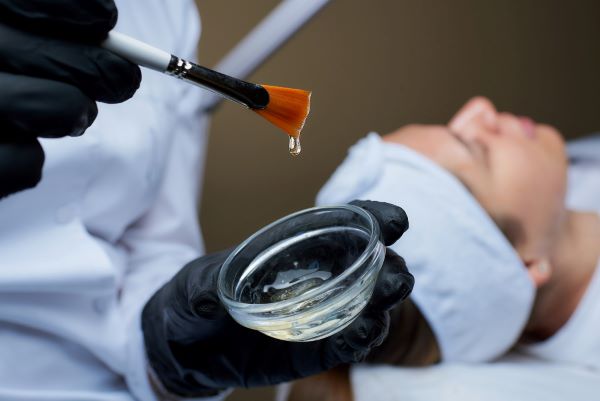 Médica dermatologista manuseando ácido graxo com pincel para aplicar na face de paciente. Conceito de peelings químicos.
